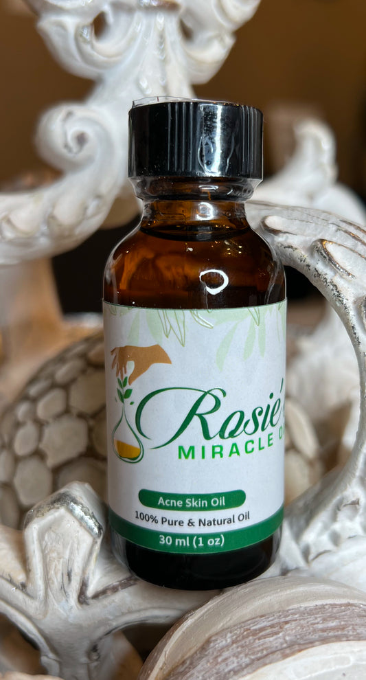 Rosie’s Miracle Oil For ACNE Prone Skin